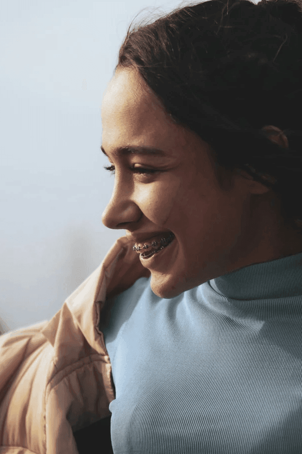 Young patient smiling in profile, showing fixed orthodontic braces