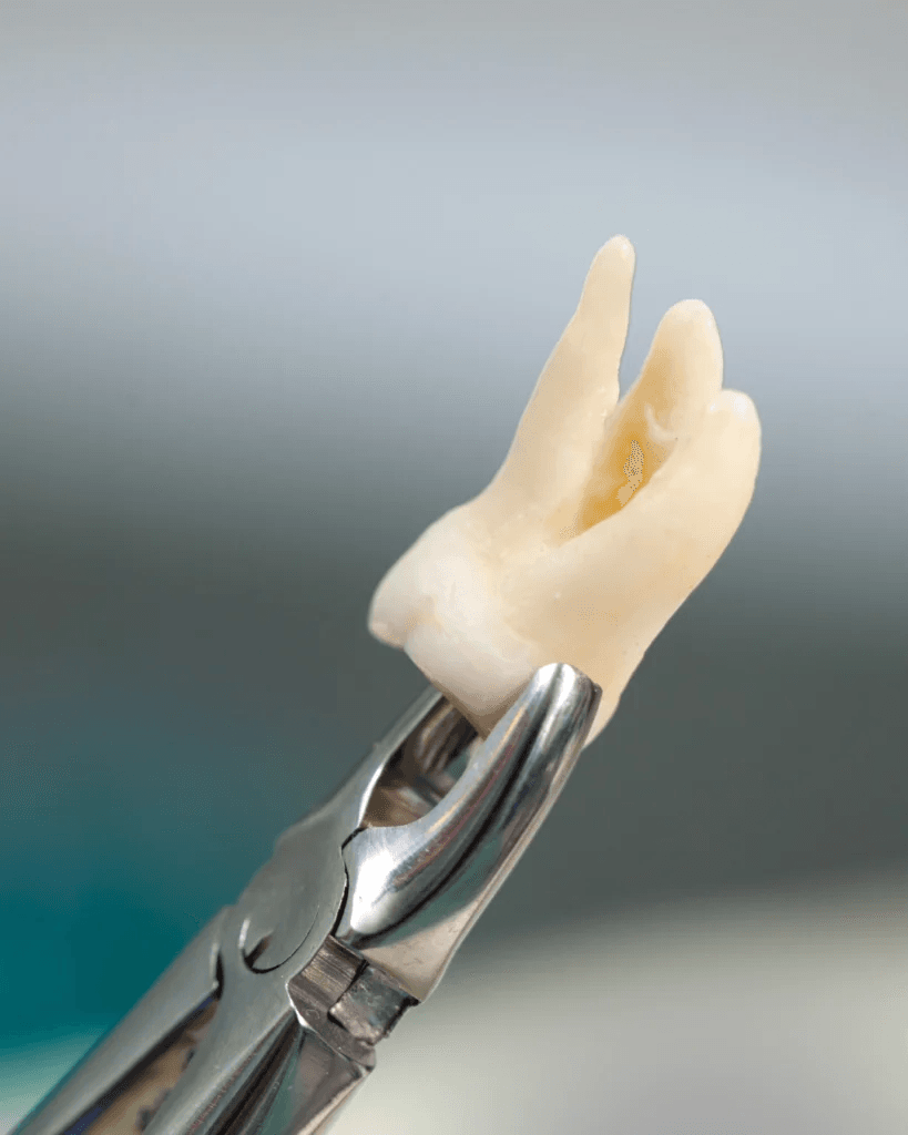 Campos Dental treatment room — equipped for calm, well-planned extractions and surgical procedures